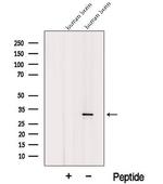 ICMT Polyclonal Antibody