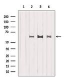 ISYNA1 Polyclonal Antibody
