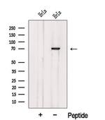 Katanin p80 Antibody in Western Blot (WB)