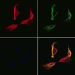SSFA2 Polyclonal Antibody
