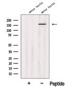 SSFA2 Antibody in Western Blot (WB)