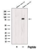 LDB3 Polyclonal Antibody