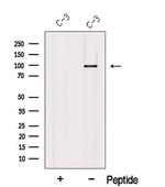 USHBP1 Polyclonal Antibody