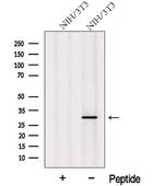 MITD1 Polyclonal Antibody