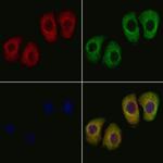 MMAB Polyclonal Antibody