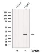 MMAB Antibody in Western Blot (WB)