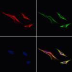 MTCH2 Polyclonal Antibody