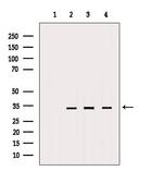 MTCH2 Antibody in Western Blot (WB)