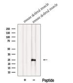 MXD1 Polyclonal Antibody