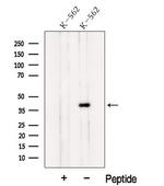ILF2 Polyclonal Antibody