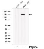 NPHP3 Polyclonal Antibody
