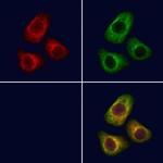 NPTX2 Polyclonal Antibody