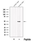 NPTX2 Antibody in Western Blot (WB)