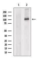 OSMR Polyclonal Antibody