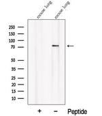 PALMD Antibody in Western Blot (WB)
