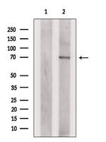 PLAGL2 Polyclonal Antibody