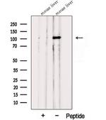 PPARGC1B Polyclonal Antibody