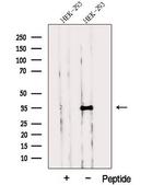 PP1 gamma Polyclonal Antibody