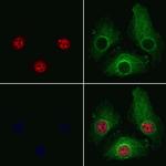 PRPF4 Polyclonal Antibody