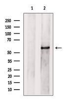 PRPF4 Antibody in Western Blot (WB)