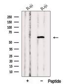 PRPF4 Antibody in Western Blot (WB)