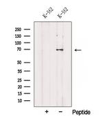 RHOT2 Antibody in Western Blot (WB)
