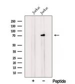 RNF12 Polyclonal Antibody