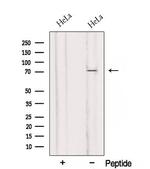RMI1 Polyclonal Antibody