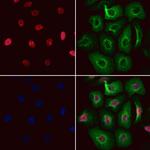 RNaseH2C Polyclonal Antibody