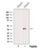 RPH3AL Polyclonal Antibody