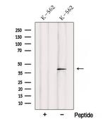 SAMSN1 Polyclonal Antibody