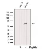 SESN3 Polyclonal Antibody