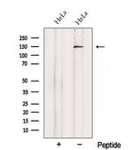 SETBP1 Antibody in Western Blot (WB)