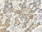 SGMS1 Antibody in Immunohistochemistry (Paraffin) (IHC (P))