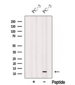 SPCS1 Polyclonal Antibody