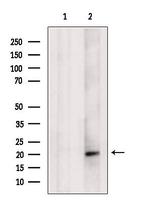 SRP19 Polyclonal Antibody