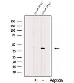 ST8SIA2 Polyclonal Antibody