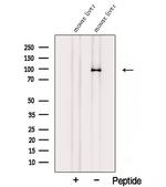 STRA6 Polyclonal Antibody