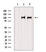 STT3A Polyclonal Antibody