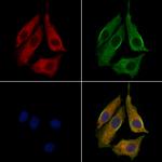 STX7 Polyclonal Antibody