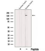TALPID3 Antibody in Western Blot (WB)
