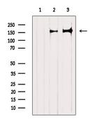 TALPID3 Polyclonal Antibody