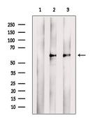 TCN2 Polyclonal Antibody