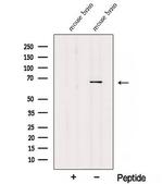 TDRKH Polyclonal Antibody