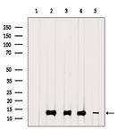 TIMM13 Polyclonal Antibody