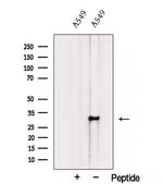TMEM106B Polyclonal Antibody