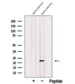 TMEM11 Polyclonal Antibody