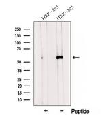 TMEM175 Polyclonal Antibody