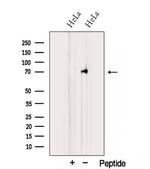 TNIP1 Polyclonal Antibody