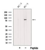 TRPV6 Antibody in Western Blot (WB)